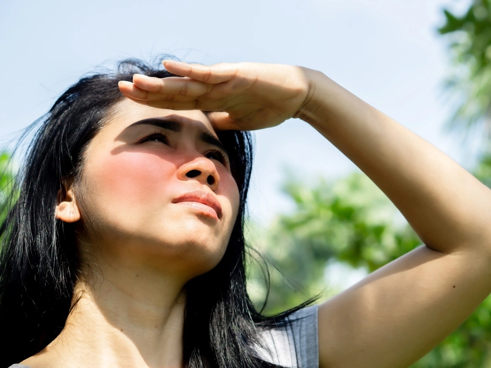 Sunburn and Mental Health: The Psychological Impact of Sun Damage